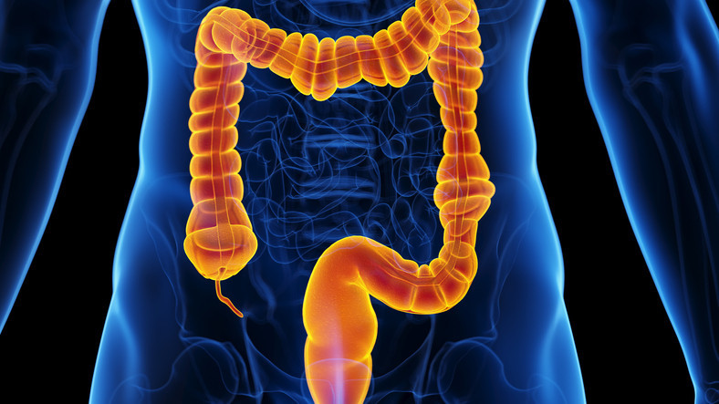 When — and how — should you be screened for colon cancer?